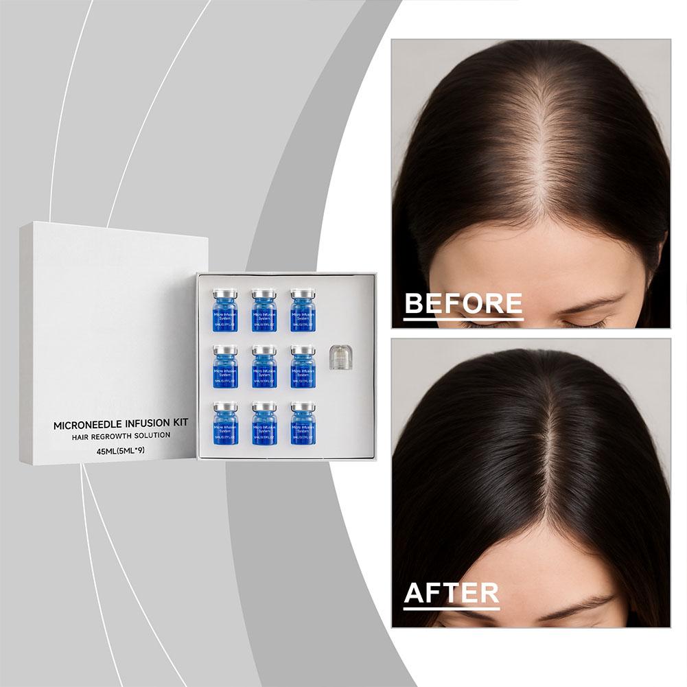 Hair Care Essence Oil - Kit de Rolo de Microagulhas com