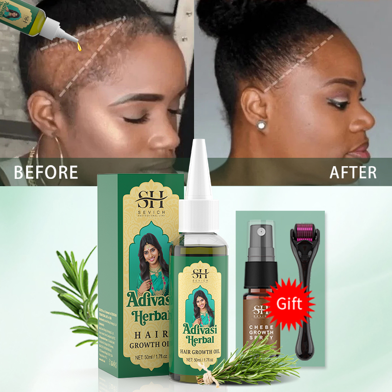 Óleo Ayurvédico para Crescimen - Hair Care Fragrance Essential Oil avaliação e preço