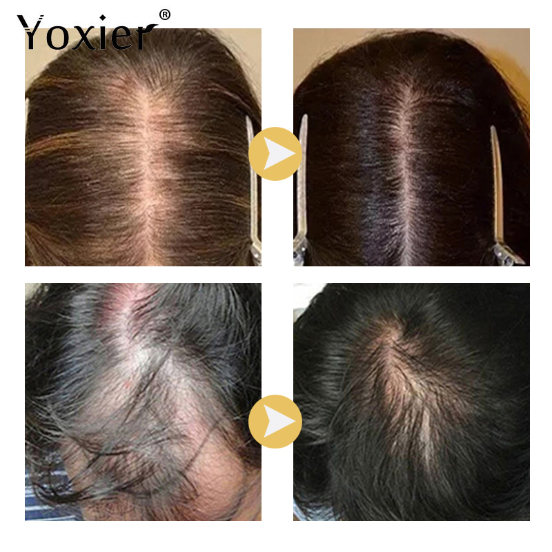 Soro de crescimento intensivo  - Hair Care Hair Serum avaliação e preço