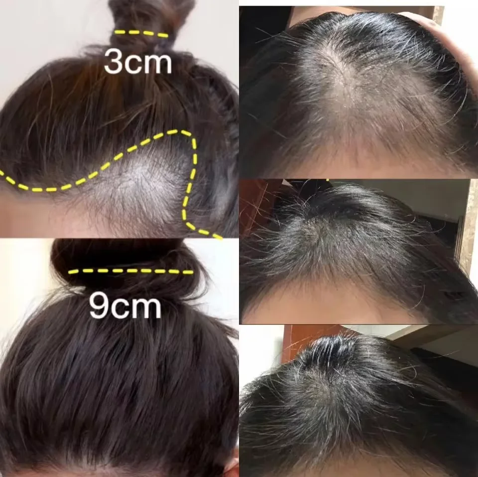 Creme rápido de crescimento ca - Hair Care Elseve avaliação e preço
