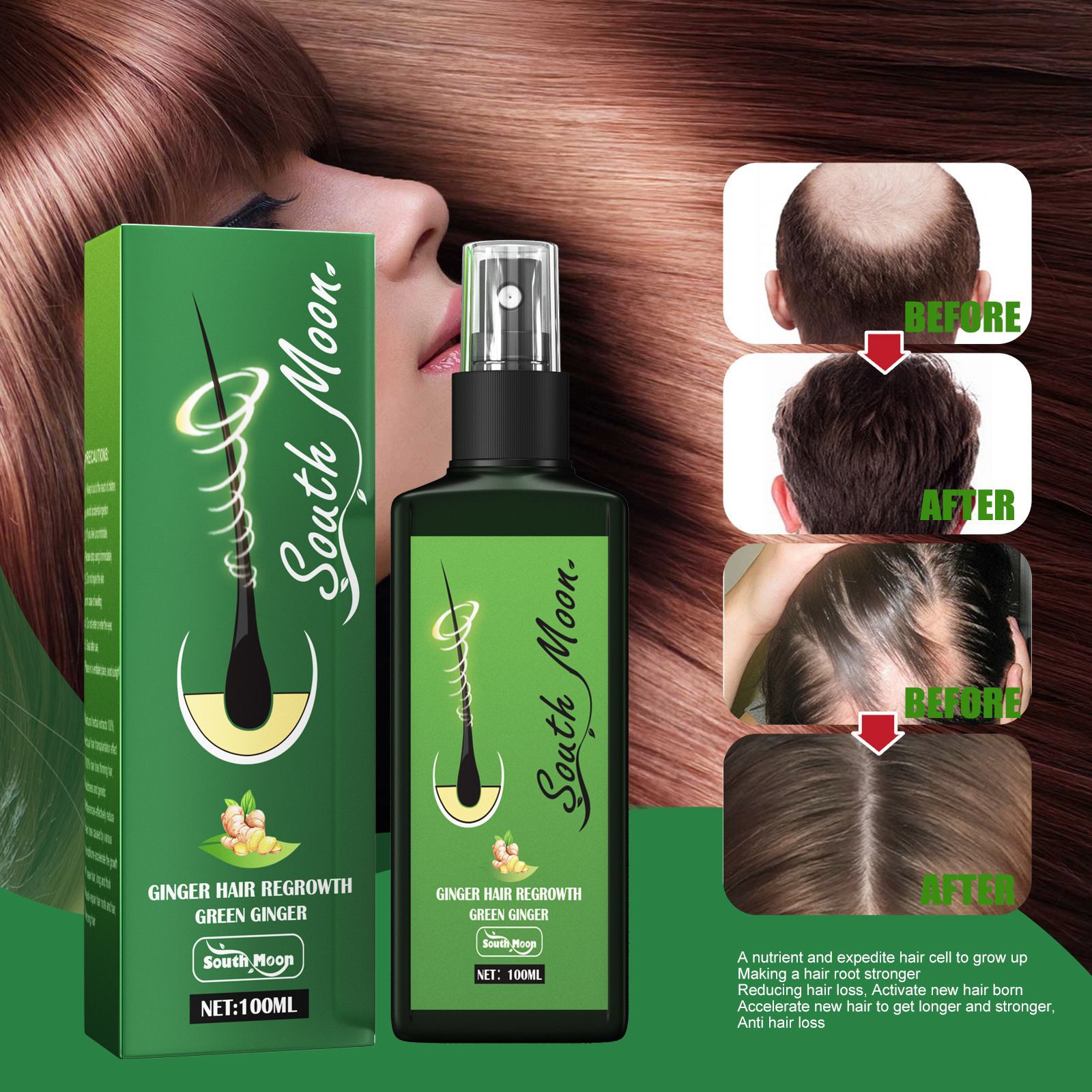 Spray de Crescimento Capilar d - Hair Care Elseve avaliação e preço