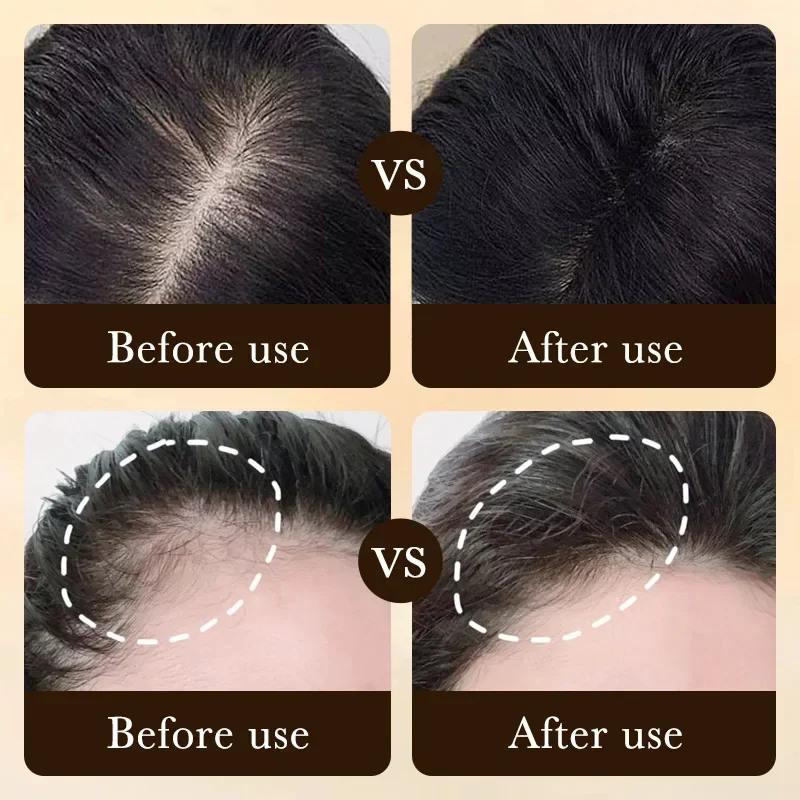 Óleo de Crescimento Rápido de  - Hair Care Fragrance Essential Oil avaliação e preço