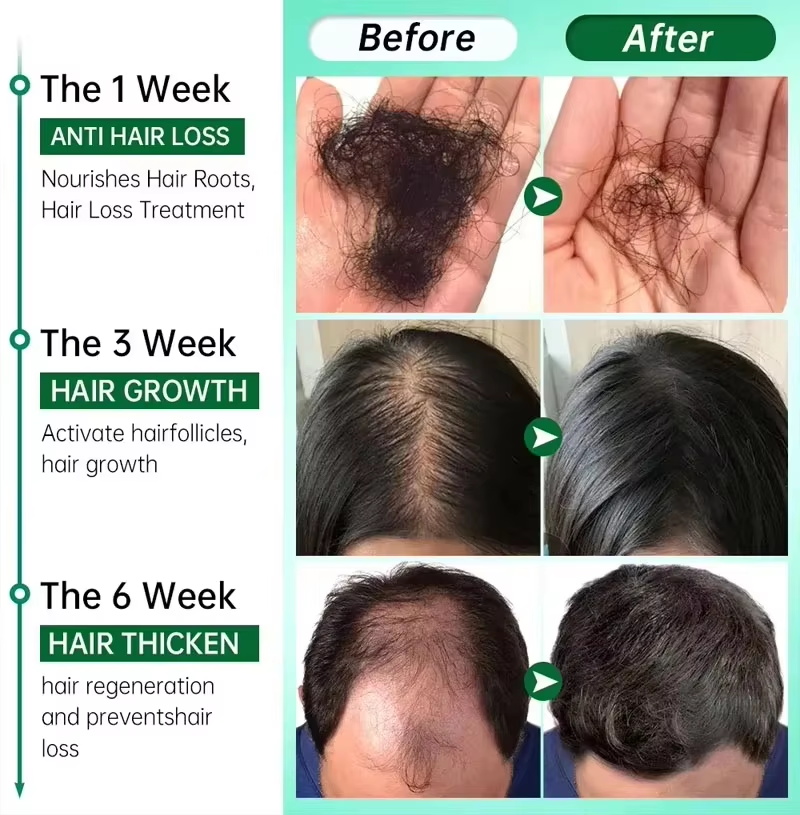 Sérum para Crescimento Capilar - Hair Care Elseve avaliação e preço