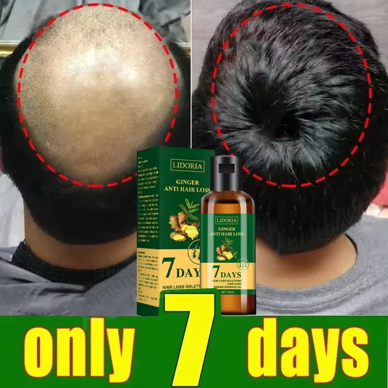 Sérum para Crescimento Capilar - Hair Care Elseve avaliação e preço