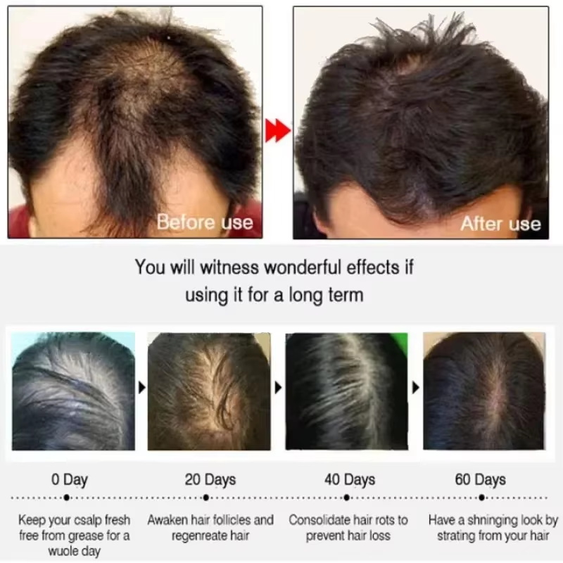 Sérum para Crescimento Capilar - Hair Care Elseve avaliação e preço