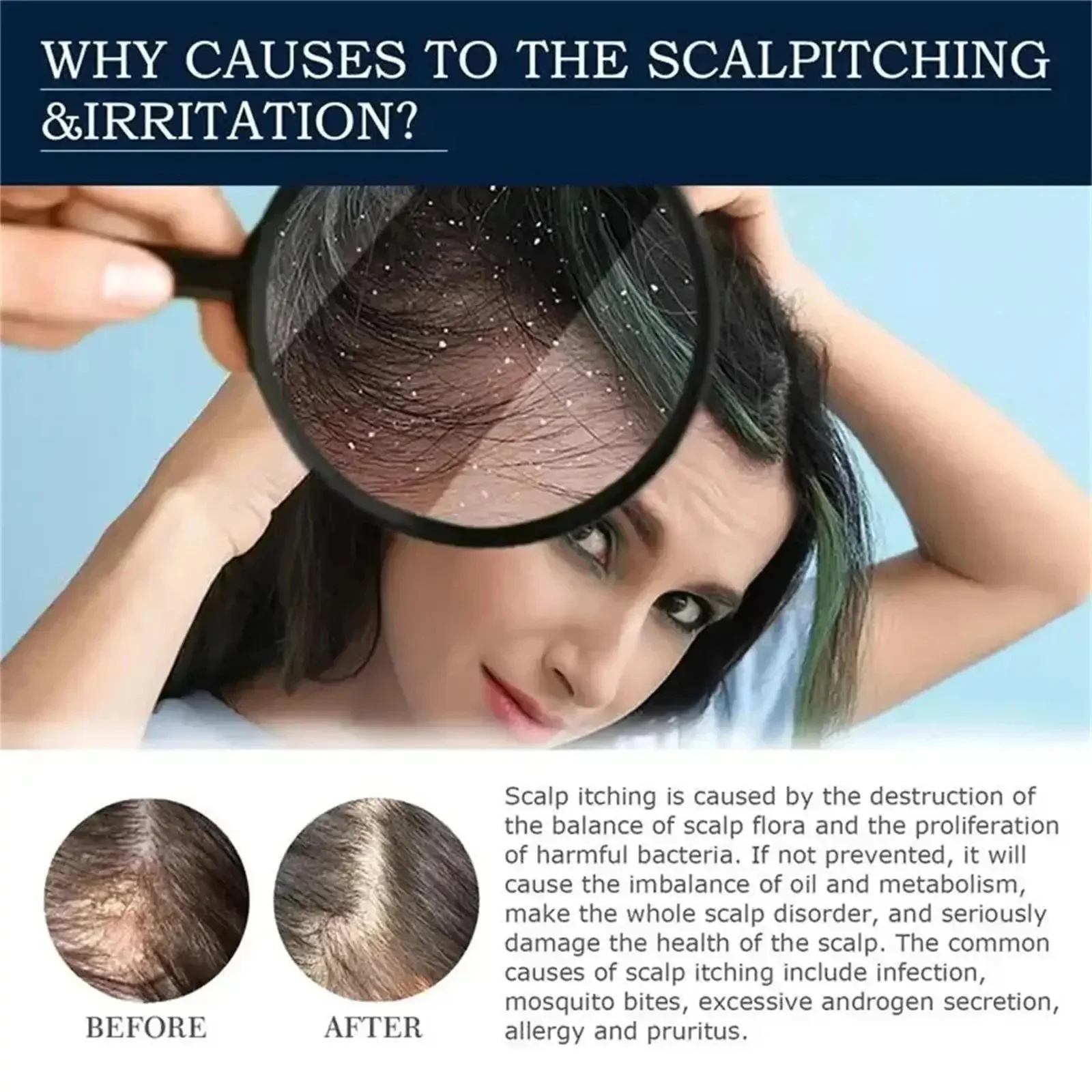 Essência de crescimento capila - Hair Care Essence Oil avaliação e preço
