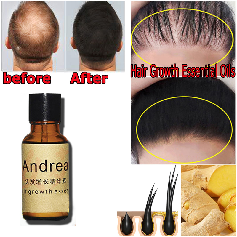 2/5/10 pçs andrea crescimento  - Hair Care Oil Serum avaliação e preço